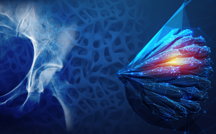 Breast Cancer induced Osteoporosis