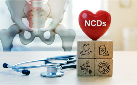vignette NCD 